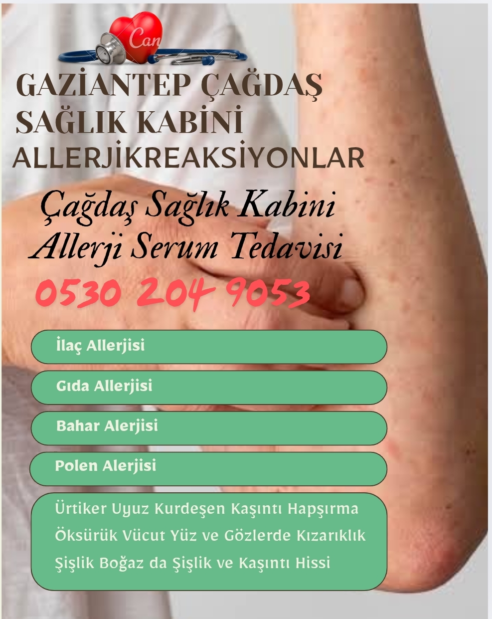 Allerjik Reaksiyonlar 